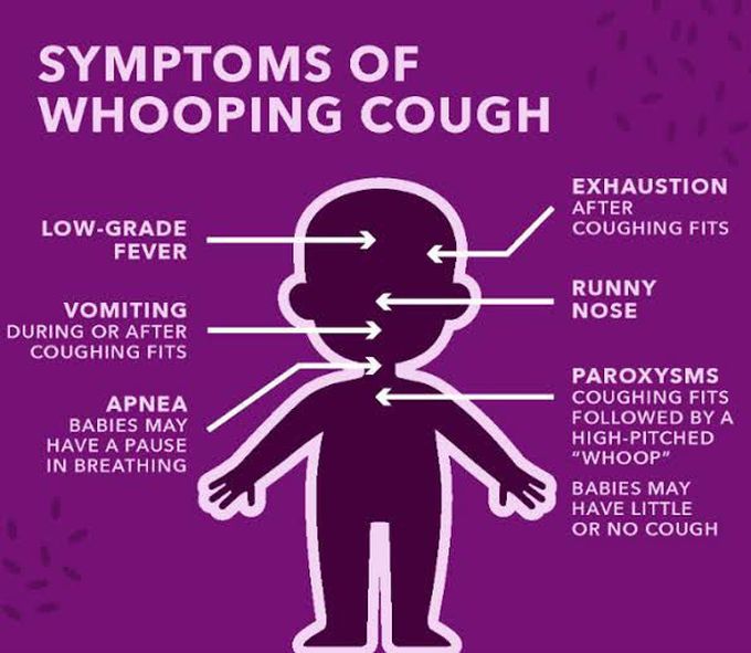 Symptoms of pertussis