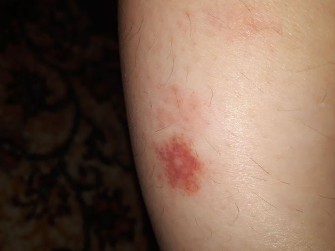 Diagnosis?