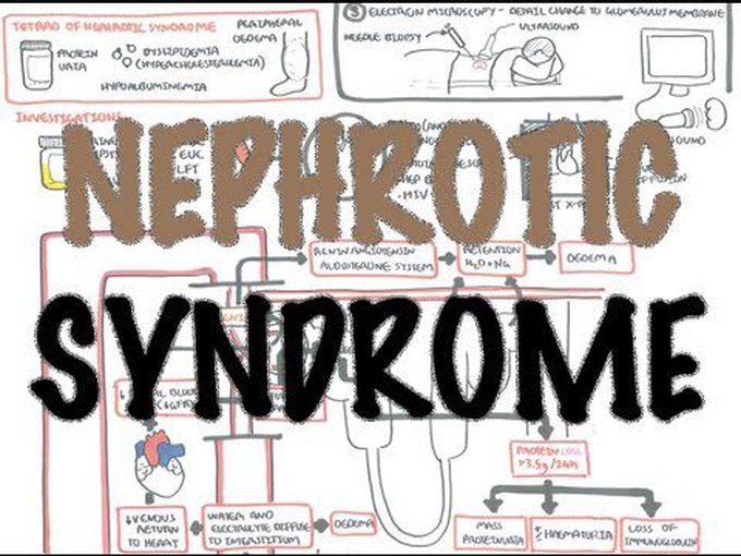 Kidney Diseases III-
Nephrotic syndrome I