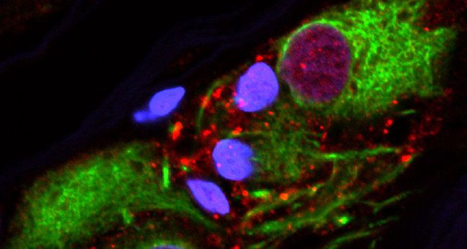 The appendix may play a role in Parkinson’s disease