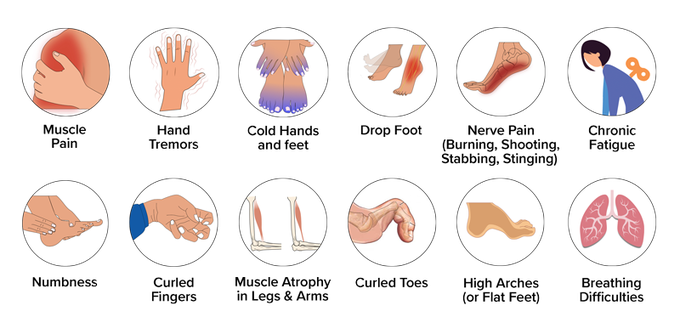 Charcot–Marie–Tooth Disease