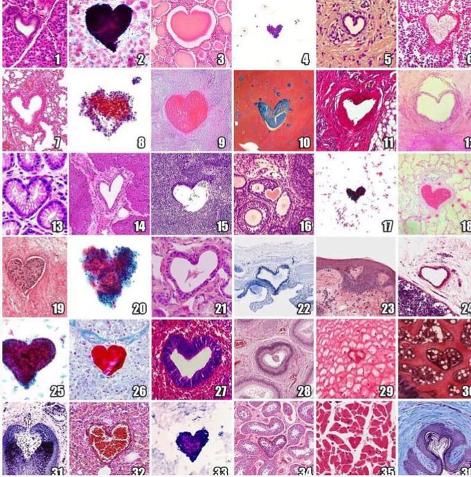 Love in Histology