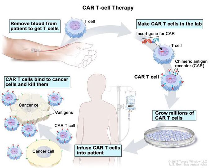 CAR T CELL THERAPY