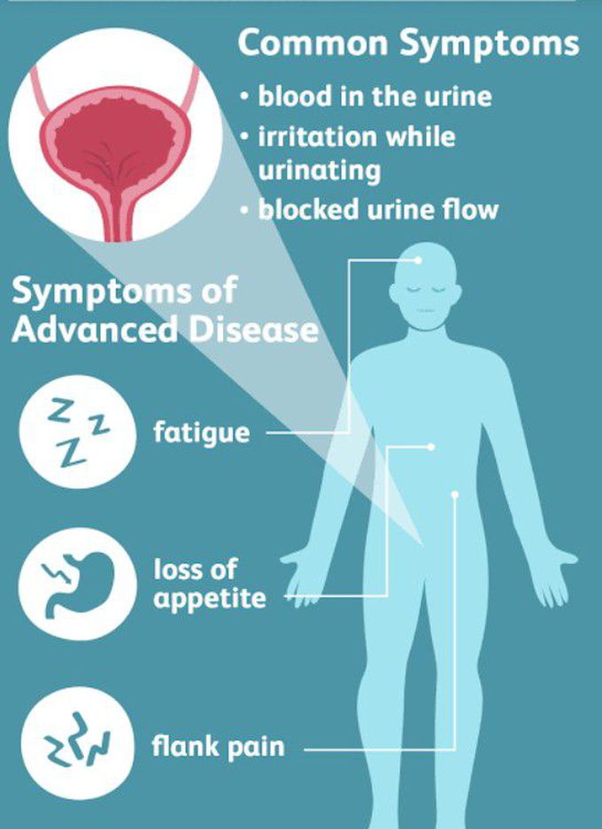 Symptoms of Bladder cancer