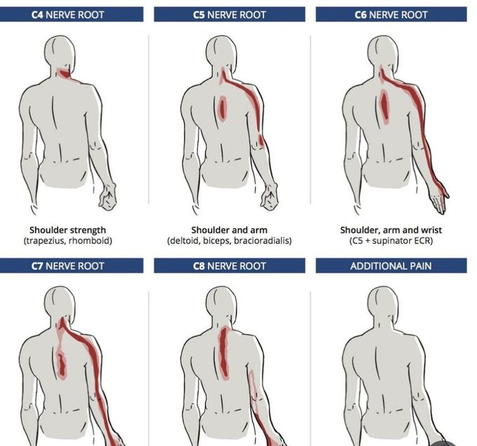 Cervical Nerves