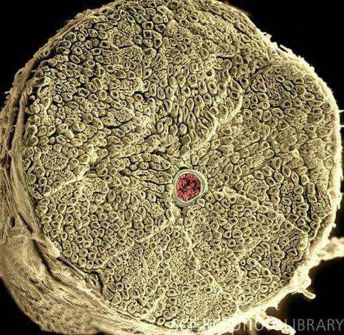 The spinal cord is a long, thin, tubular bundle of nervous tissue and support cells that extends from the medulla oblongata in the brainstem to the lumbar region of the vertebral column. The brain and spinal cord together make up the central nervous system (CNS). In humans, the spinal cord begins at the occipital bone where it passes through the foramen magnum, and meets and enters the spinal canal at the beginning of the cervical vertebrae. The spinal cord extends down to between the first and second lumbar vertebrae where it ends. The enclosing bony vertebral column protects the relatively shorter spinal cord. It is around 45 cm (18 in) in men and around 43 cm (17 in) long in women. Also, the spinal cord has a varying width, ranging from 13 mm (1⁄2 in) thick in the cervical and lumbar regions to 6.4 mm (1⁄4 in) thick in the thoracic area.