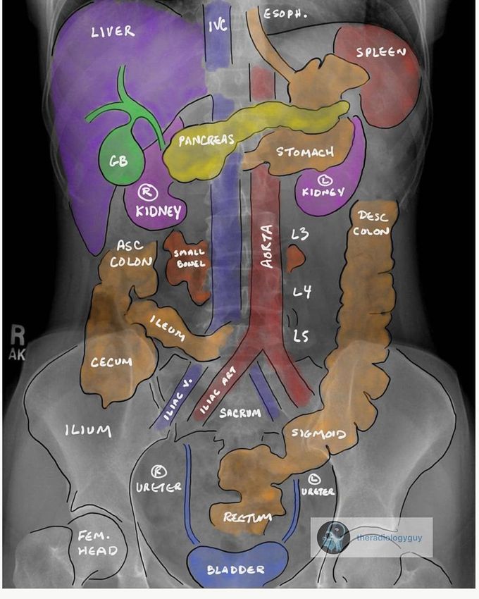 The ABDOMEN X-RAY: