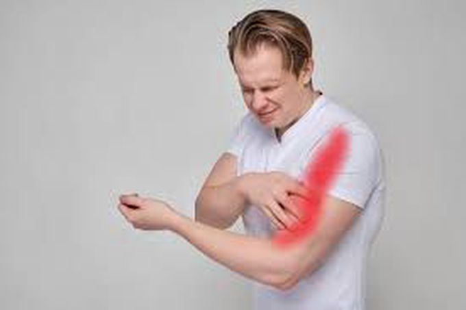 What are the symptoms of a biceps tendon tear