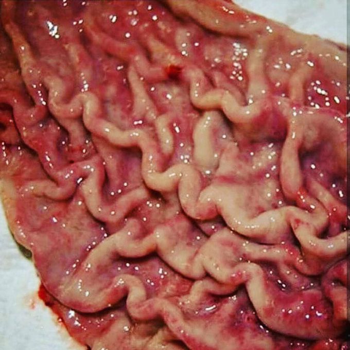 That's how your stomach looklike when you get hungery