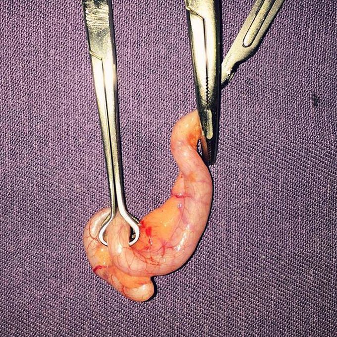 Appendix