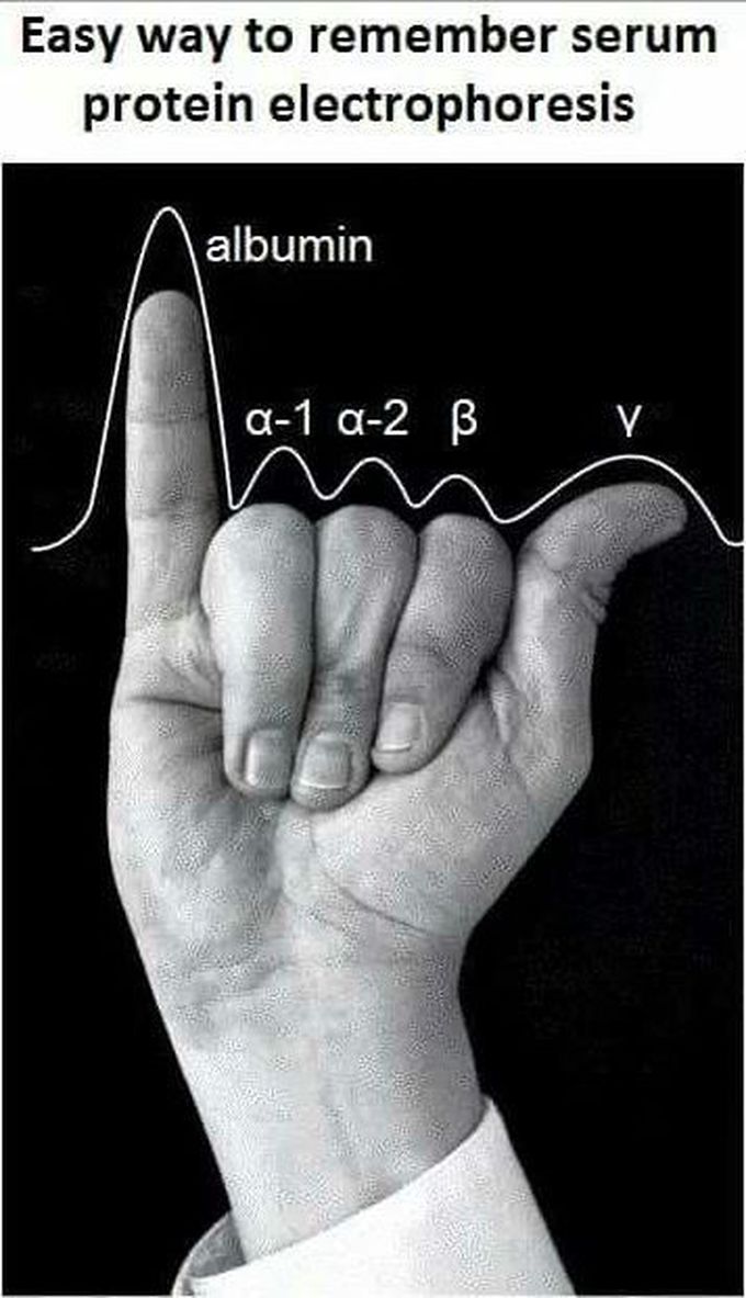 Easy way to remember serum protein electrophoresis