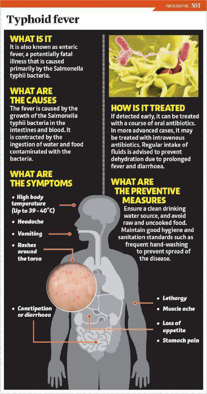 Typhoid fever