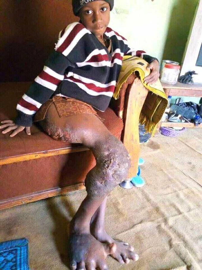 What is your diagnosis???