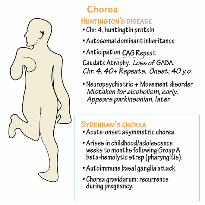 Sydenhams chorea