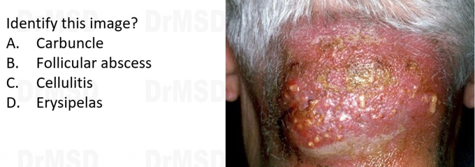 Test your dermatology knowledge,identify and prescribe medicine😉😉😉