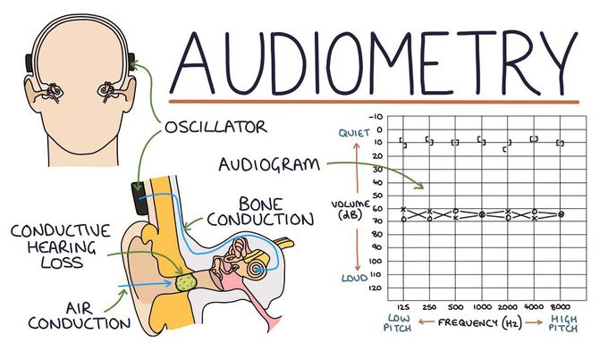 Understanding Audiometry and Audiograms
