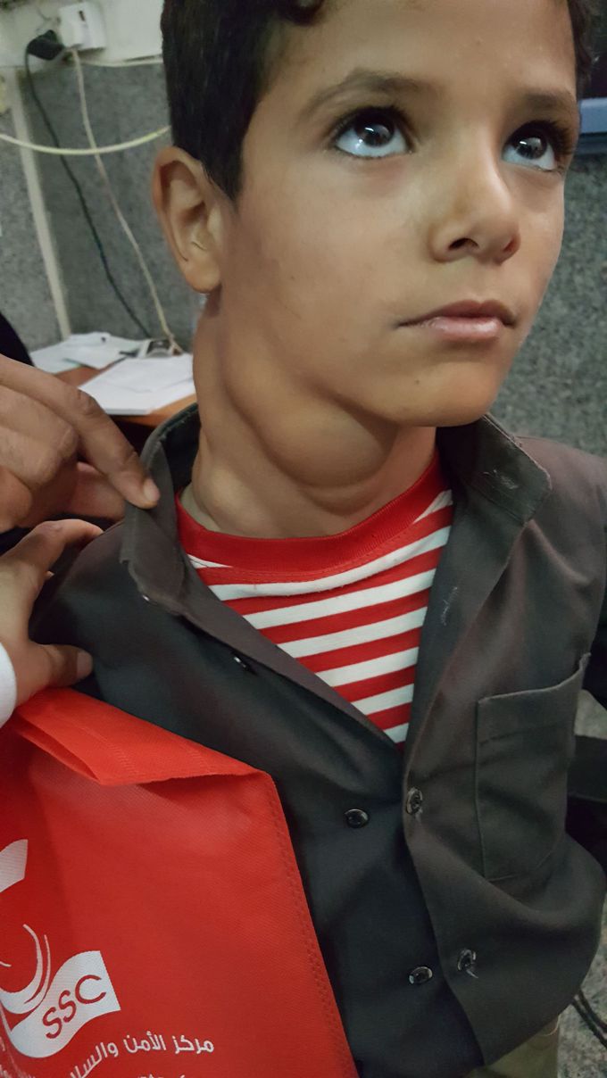 Neck swelling