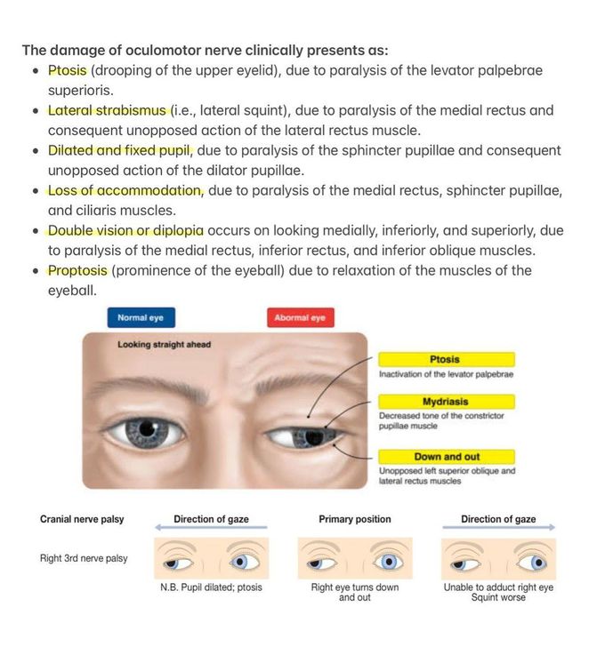 Oculomotor Nerve I