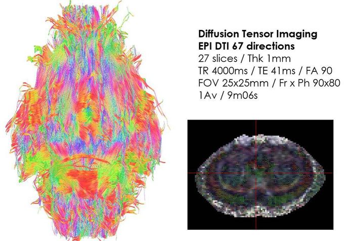 Diffusion tensor imaging of the rat brain at 7 Tesla!