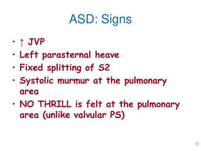 ASD -Signs