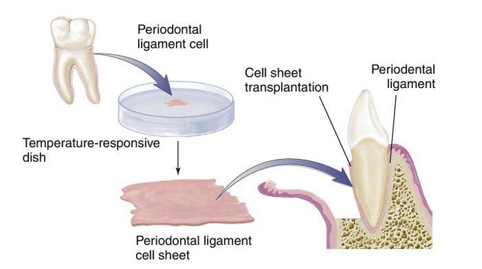 Periodontal ligament engineering