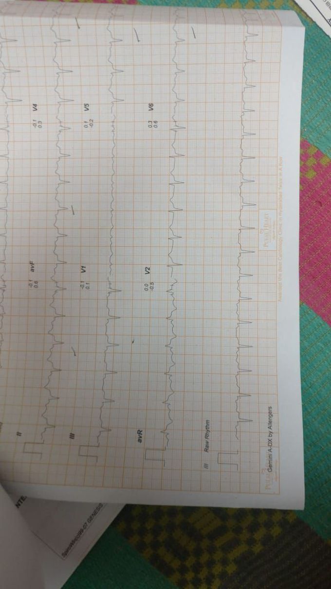 ECG.What is your inference?