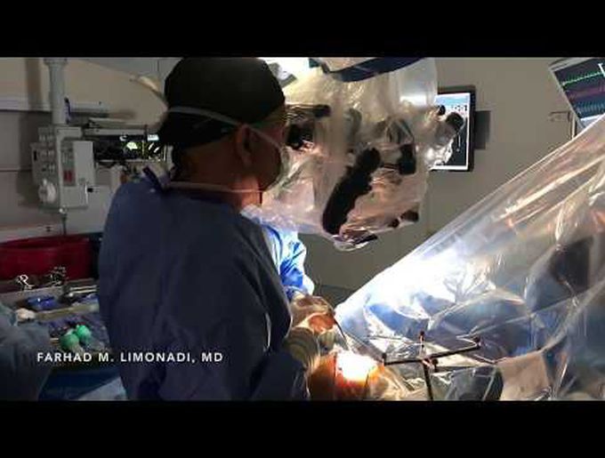 Awake Brain Surgery: Video presentation of brain tumor resection.