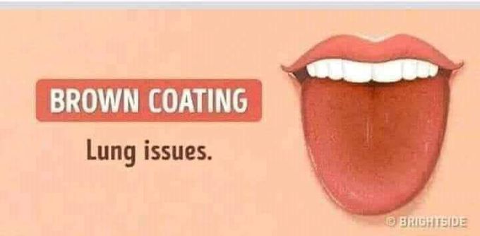 Lung diseased