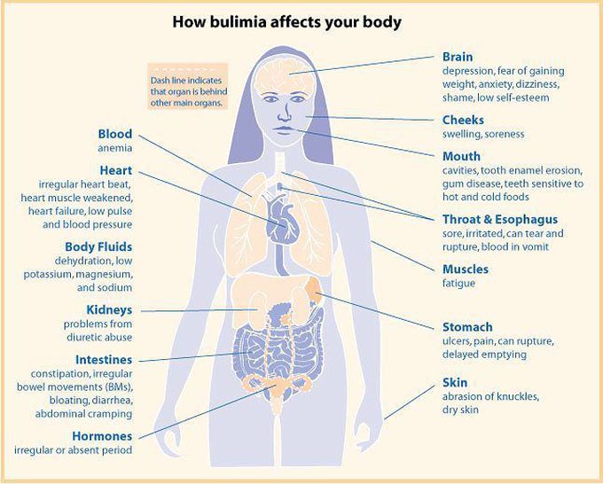 Bulimia Nervosa Effects