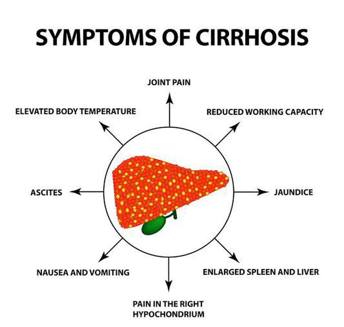These are the symptoms of cirrhosis