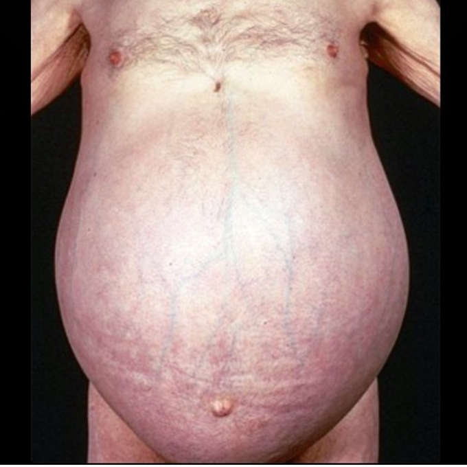 Diagnosis?