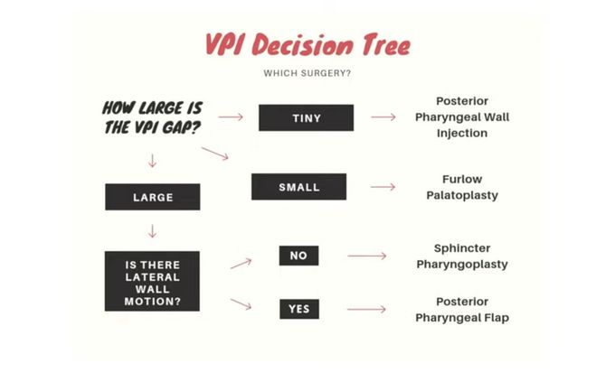VelopaIatopharygeal Decision Tree