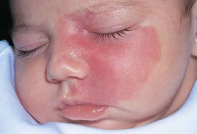 What is diagnosis?
