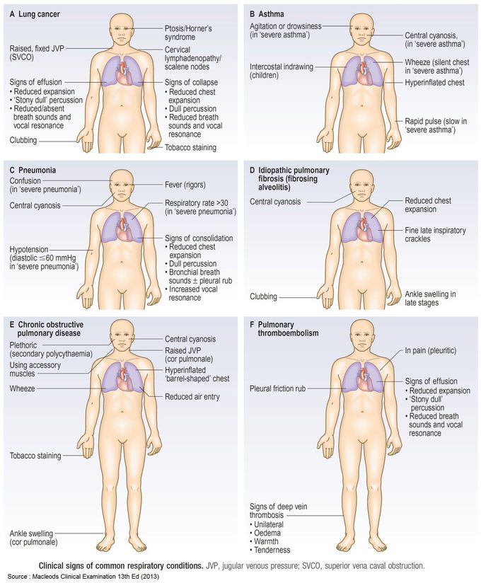 Clinical signs of common respiratory conditions