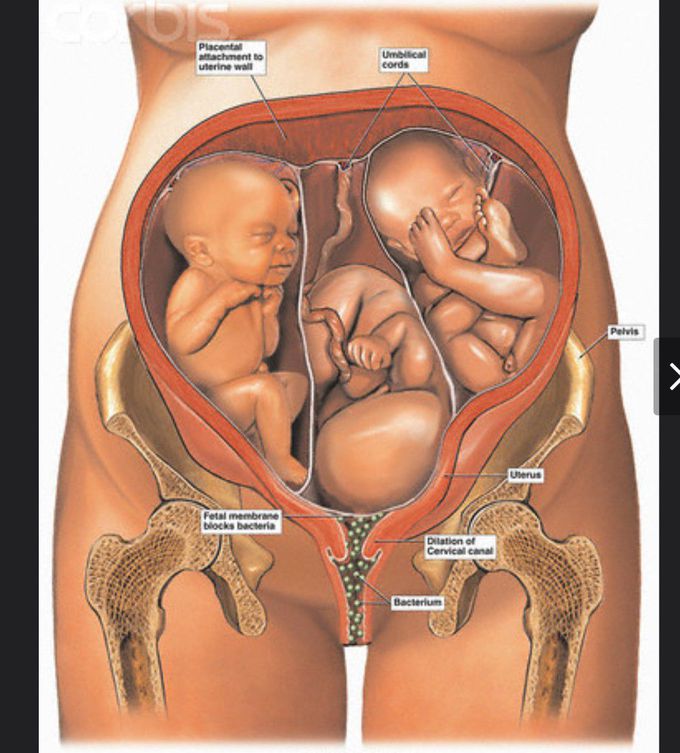 Medical exhibit pictures