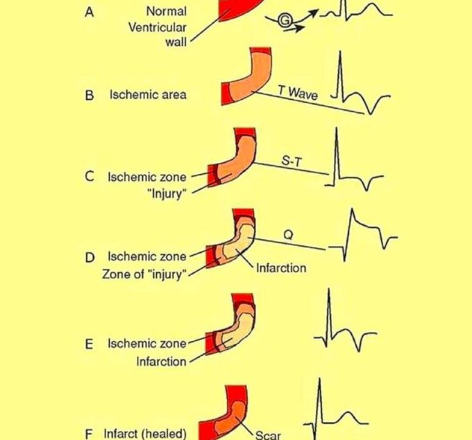 ECG drreza