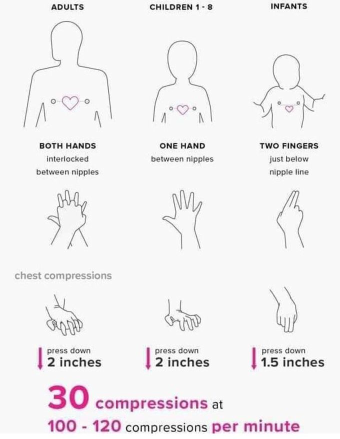 Cardiopulmonary Resuscitation