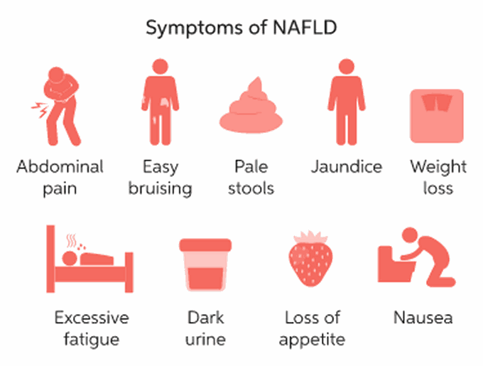 These are the symptoms of NAFLD