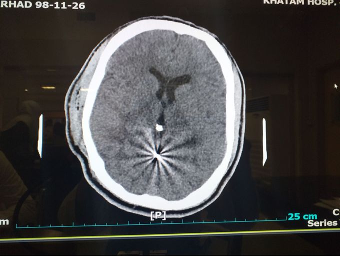 What is your diagnosis?
