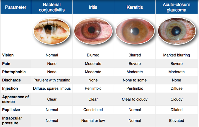Red Eye - Differential Diagnosis