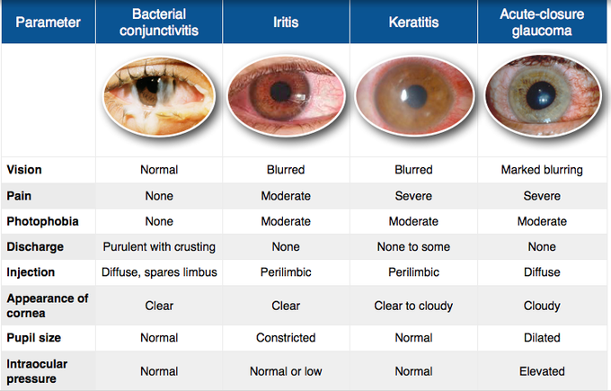 red-eye-differential-diagnosis-medizzy