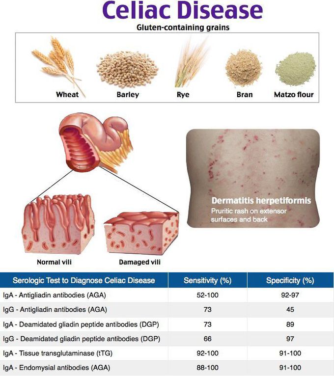 Celic disease