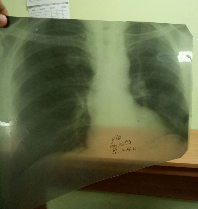 What's your diagnosis??