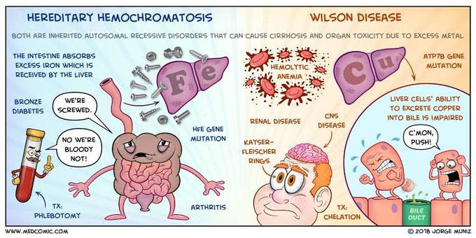 Hereditary Hemochromatosis Vs Wilson Disease