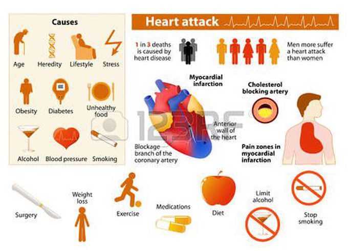 Treatment and causes oh Heart Attack