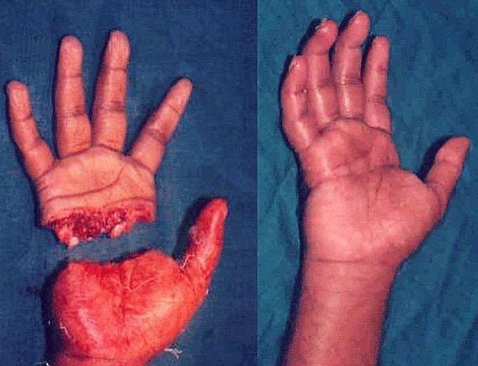 It is impressive how surgery works! 