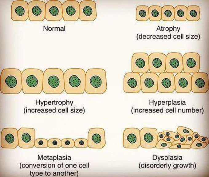 It's all about cells