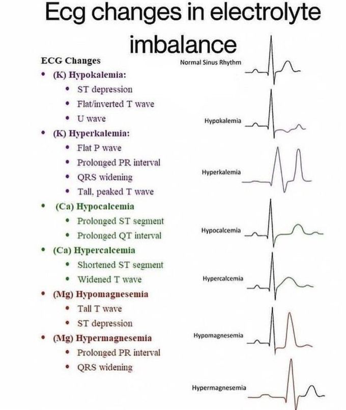 ECG CHANGES