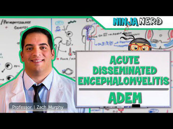 Acute Disseminated Encephalomyelitis