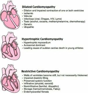 Types of cardiomyopathies... - MEDizzy